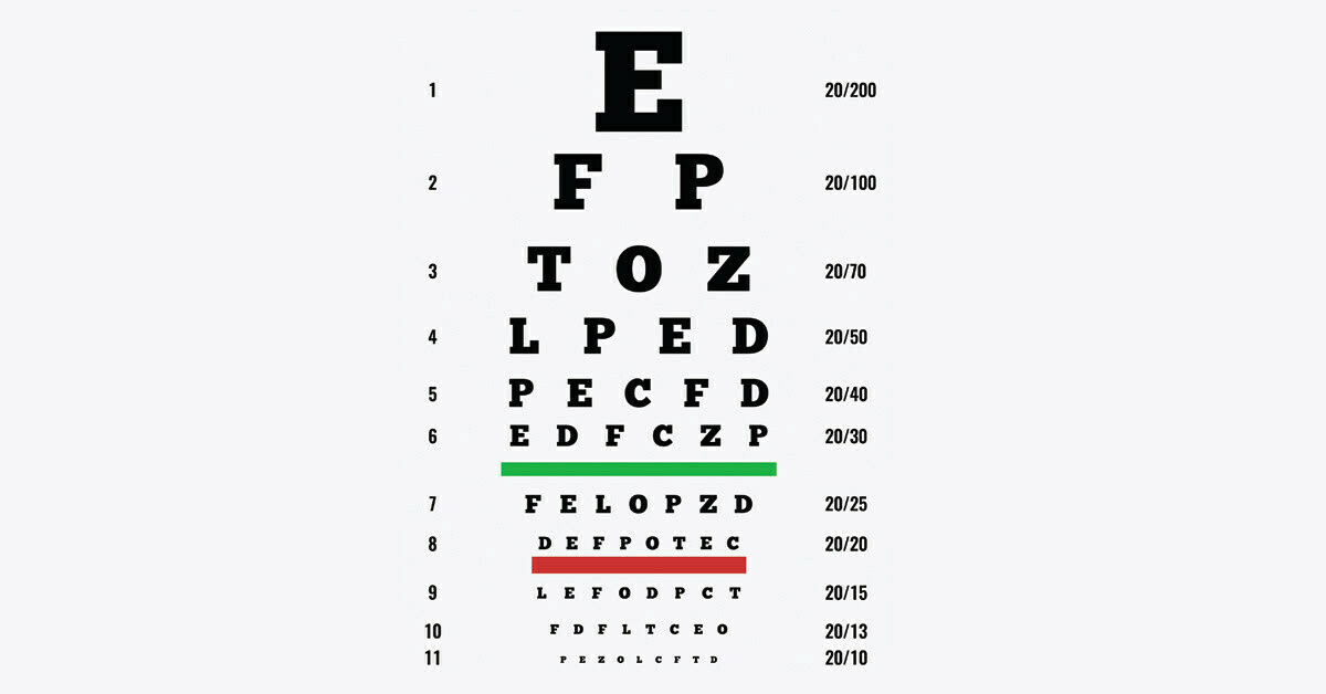 Will I have 20/20 Vision after LASIK?