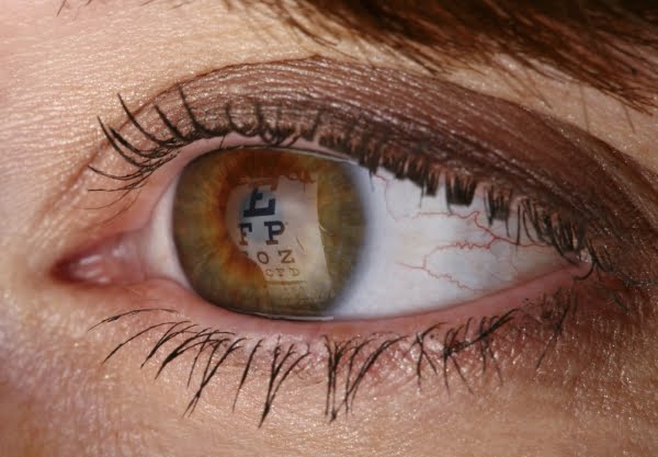 How Laser Cataract Surgery is Performed