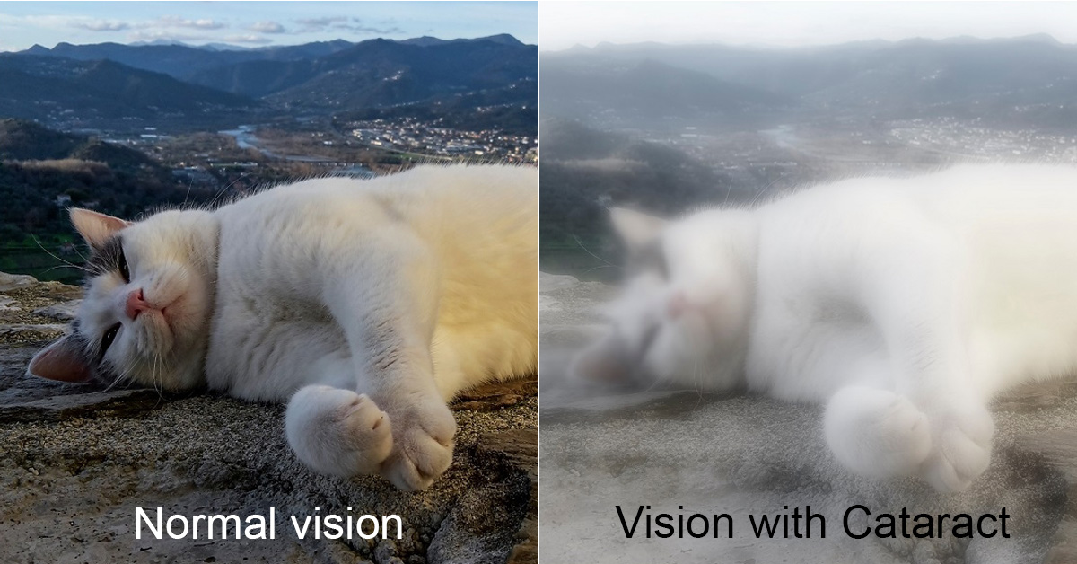 Cataract Vision Example