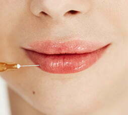 Lip Injection