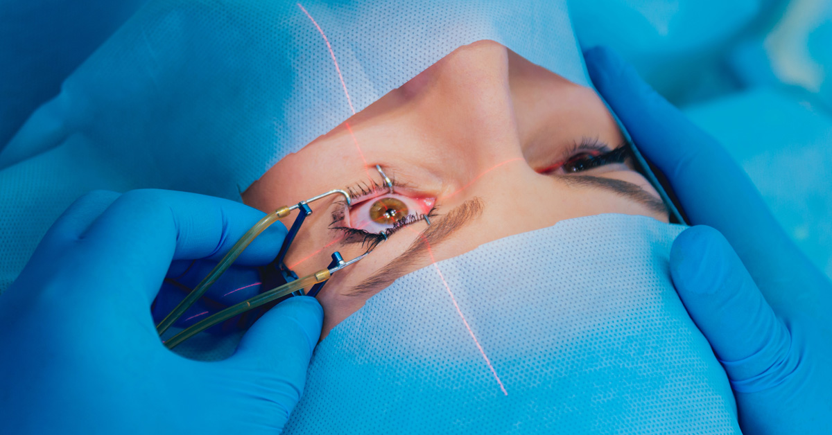 The Significance of Choosing the Right Eye Doctor for Your LASIK Eye Surgery